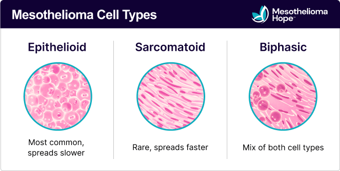 Mesothelioma Cell Types