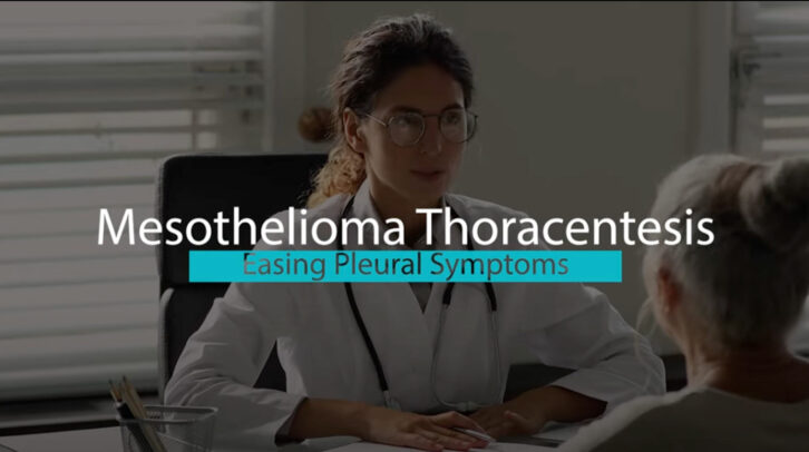 Thoracentesis for Pleural Mesothelioma | Mesothelioma Hope Video Thumbnail