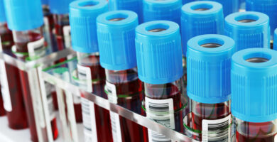 A rack with several rows of scientifically-labelled blood vials stand with blue lids, ready for testing.