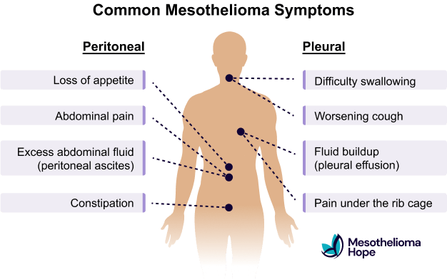 Infographic showing the most common mesothelioma symptoms and how they affect different parts of the body