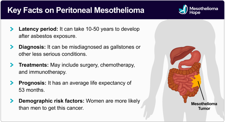 List of key facts on peritoneal mesothelioma (including the latency period, diagnosis, treatments, prognosis, and risk factors) that features an illustrated highlight of where a mesothelioma tumor might present in a patient's body.